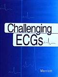 Challenging Ecgs