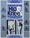 Arthritis of the Hip & Knee The Active Persons Guide to Taking Charge