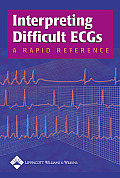 Interpreting Difficult ECG's: A Rapid Reference