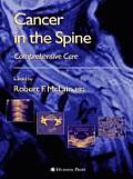Cancer in the Spine: Comprehensive Care
