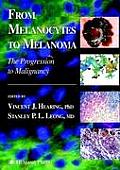 From Melanocytes to Melanoma: The Progression to Malignancy
