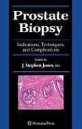 Prostate Biopsy: Indications, Techniques, and Complications