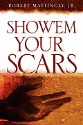 Show'em Your Scars