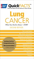 Quickfacts Lung Cancer