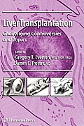 Liver Transplantation: Challenging Controversies and Topics