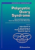Polycystic Ovary Syndrome: Current Controversies, from the Ovary to the Pancreas