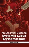 Essential Guide to Systemic Lupus Erythematosus