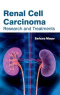 Renal Cell Carcinoma: Research and Treatments