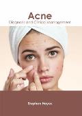 Acne: Diagnosis and Clinical Management