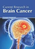 Current Research in Brain Cancer