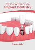 Clinical Advances in Implant Dentistry