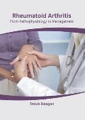 Rheumatoid Arthritis: From Pathophysiology to Management