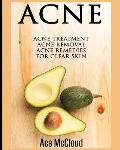 Acne: Acne Treatment: Acne Removal: Acne Remedies For Clear Skin