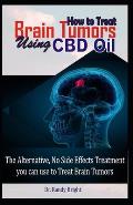 How to Treat Brain Tumors Using CBD Oil: The Alternative No Side Effects Treatment you can use to Treat Brain Tumors
