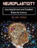 Neuroplasticity: Scanning Deviant and Standard Brains for Science