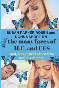 The Many Faces of M.E. and CFS: Real, Raw, Short Stories by Actual Patients