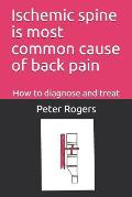 Ischemic Spine Is Most Common Cause of Back Pain: How to Diagnose and Treat