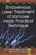 Endovenous Laser Treatment of Varicose Veins: Practical Technique