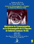 Marcadores Cromosomopat?as en la Ultrasonografia de II Trimestre de Embarazo (Semana 18-22)