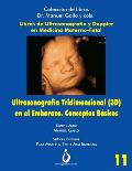 Ultrasonografia Tridimensional en el Embarazo (3D). Conceptos B?sicos