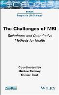 The Challenges of MRI