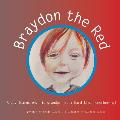 Braydon The Red