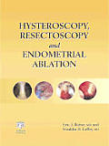 Hysteroscopy Resectoscopy & Endometrial Ablation