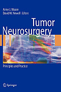 Tumor Neurosurgery: Principles and Practice