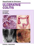 Ulcerative Colitis: Visual Guide for Clinicians