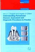 Understanding Periodontal Diseases