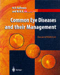 Common Eye Diseases & Their Management