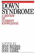 Down Syndrome: A Review of Current Knowledge