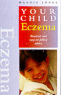 Your Child Eczema