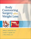 Body Contouring Surgery After Weight Loss