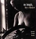 My Breasts My Choice Journeys Through Surgery