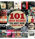 101 Irish Records You Must Hear Before You Die