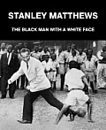 Stanley Matthews: The Black Man with a White Face