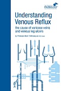 Understanding Venous Reflux the Cause of Varicose Veins and Venous Leg Ulcers: Varicose veins and venous leg ulcers