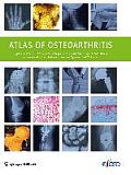Atlas of Osteoarthritis