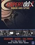 Expert Dd Brain and Spine