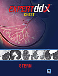 Expertddx(tm): Chest: Published by Amirsys(r) (Expertddx)