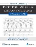 Essential Concepts of Electrophysiology Through Case Studies: Intracardiac EGMs: Intracardiac EGMs