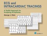 ECG and Intracardiac Tracings: A Toolkit Approach for Analyzing Arrhythmias