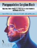 Pterygopalatine Ganglion Block: for effective treatment of Migraine, Cluster Headache, Postdural Puncture Headache & Postoperative Pain