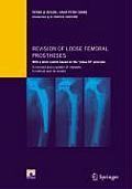 Revision of Loose Femoral Prostheses with a Stem System Based on the press-Fit Principle: A Concept and Its System of Implants, a Method and Its Res