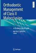 Orthodontic Management of Class II Malocclusion: An Evidence-Based Guide