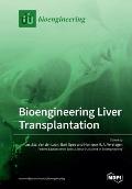 Bioengineering Liver Transplantation