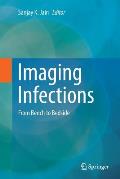 Imaging Infections: From Bench to Bedside