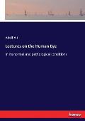 Lectures on the Human Eye: In its normal and pathological conditions