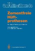 Zementfreie H?ftprothesen: Grundlagen, Erfahrungen, Tendenzen